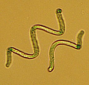 spirul2