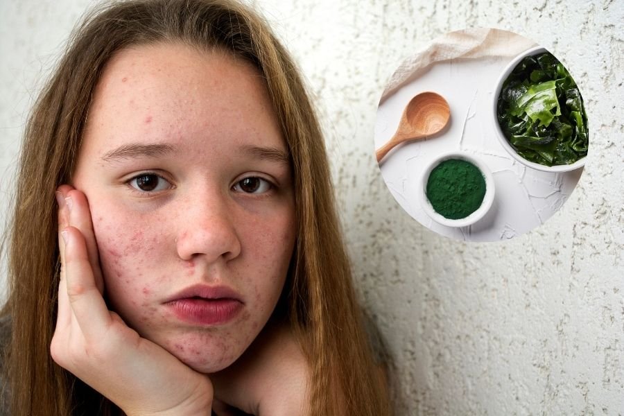 tao-xoan-spirulina-co-tot-cho-da-khong-ho-tro-cham-soc-da-tu-ben-trong